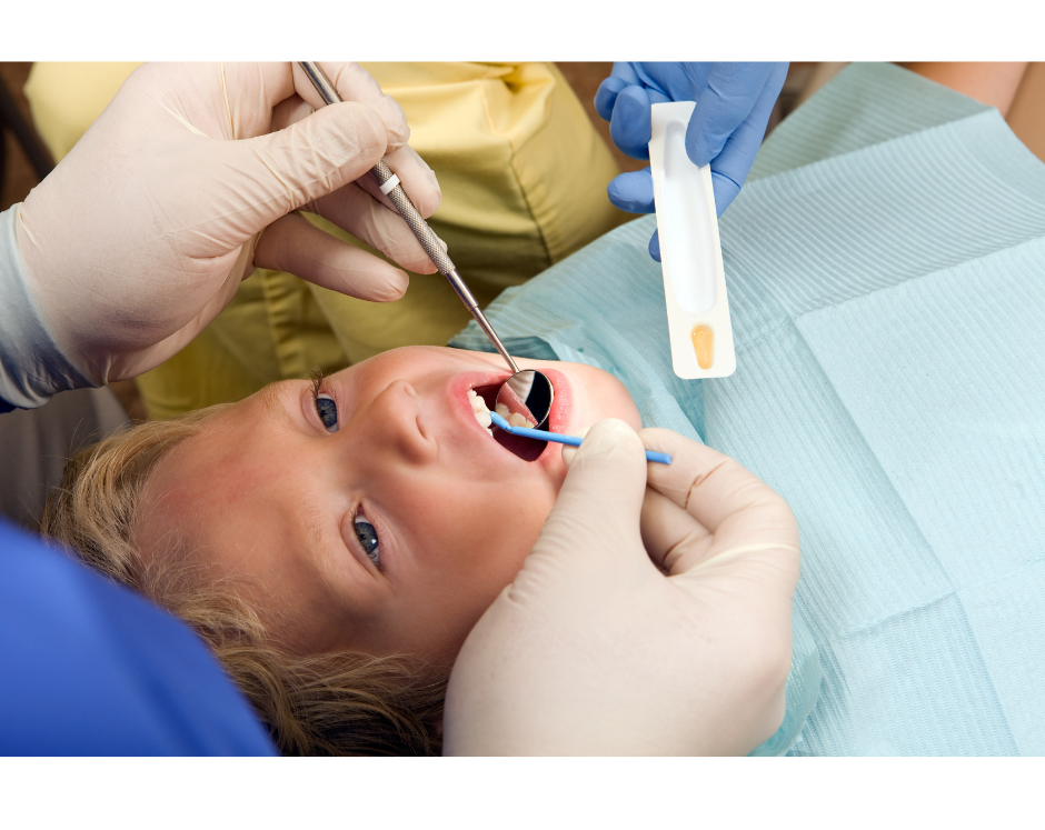 Fluoride Varnish